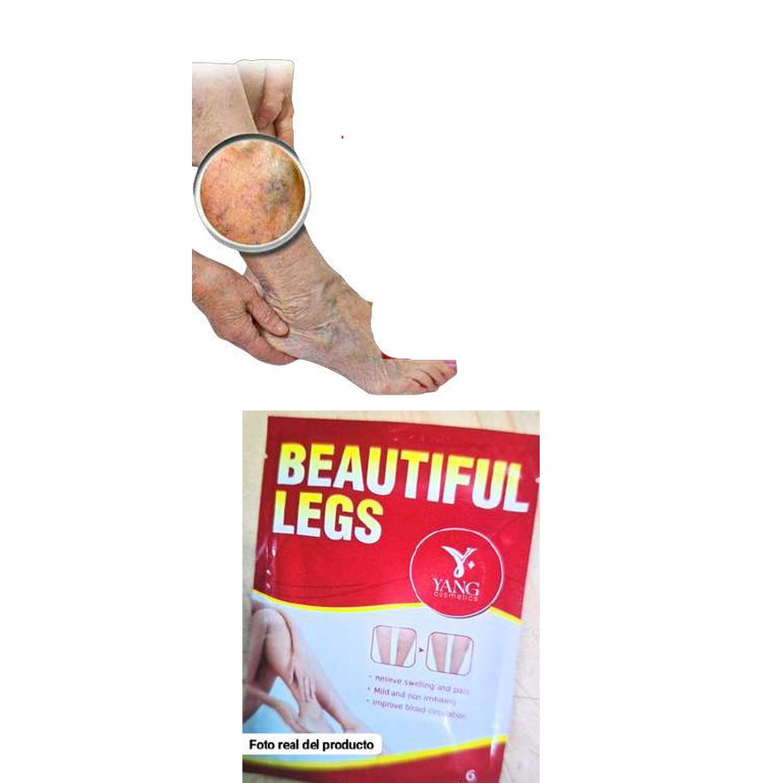 Parches para varices